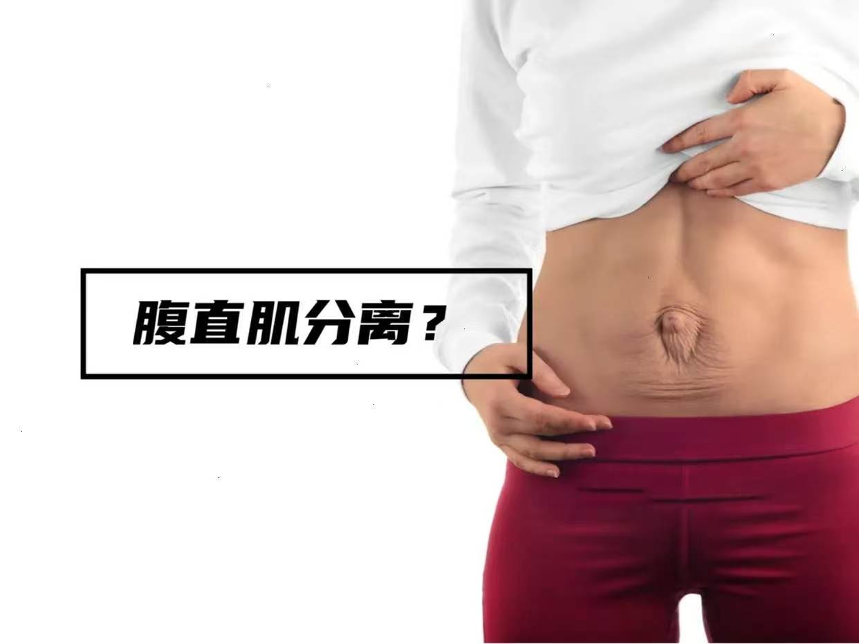 什么是腹直肌分离? 产后60-90%的宝...