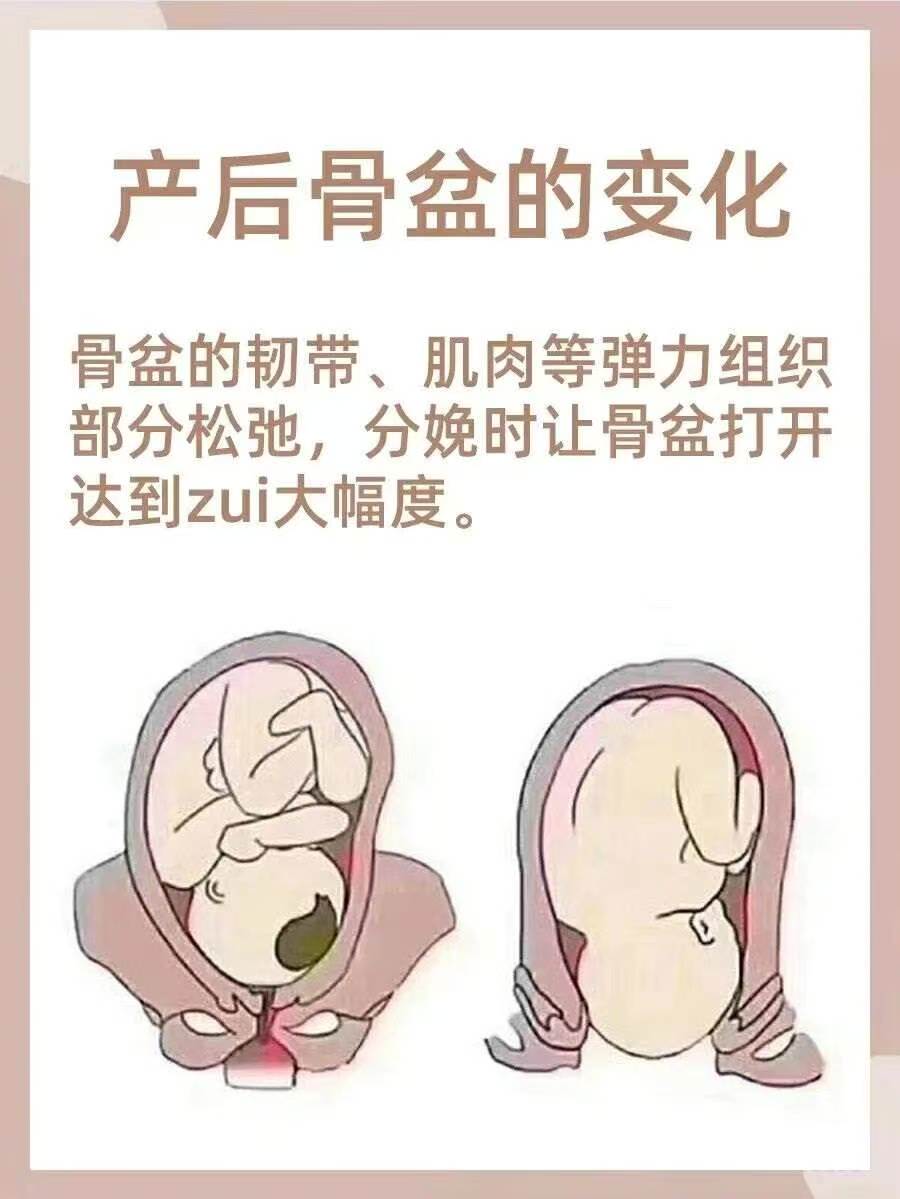 首先,我们要为顺产自然分娩正名。