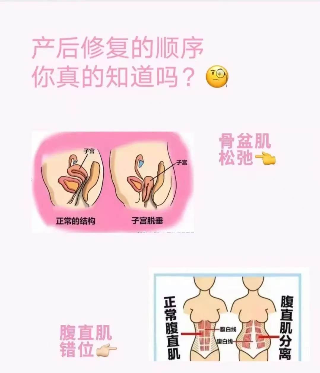 产后修复~盆底肌,腹直肌】