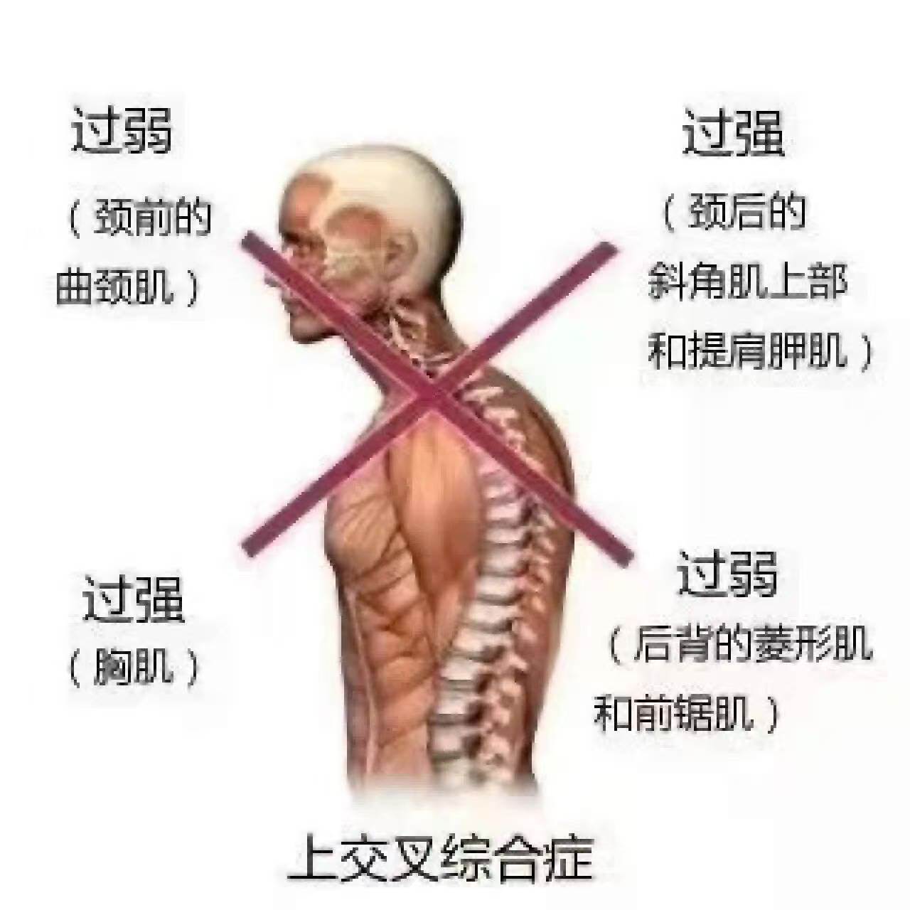 肩颈不好,人更显老!