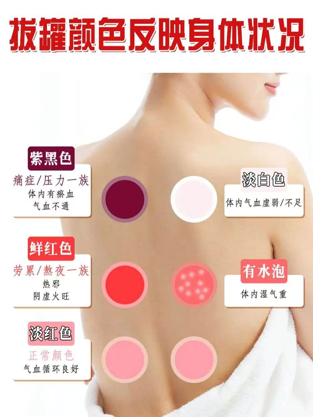 什么 拔罐后的颜色就能反映身体状况