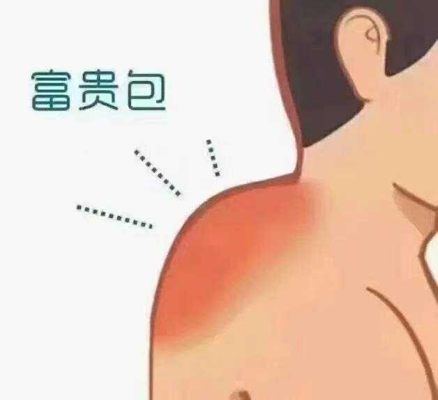 小知识分享: