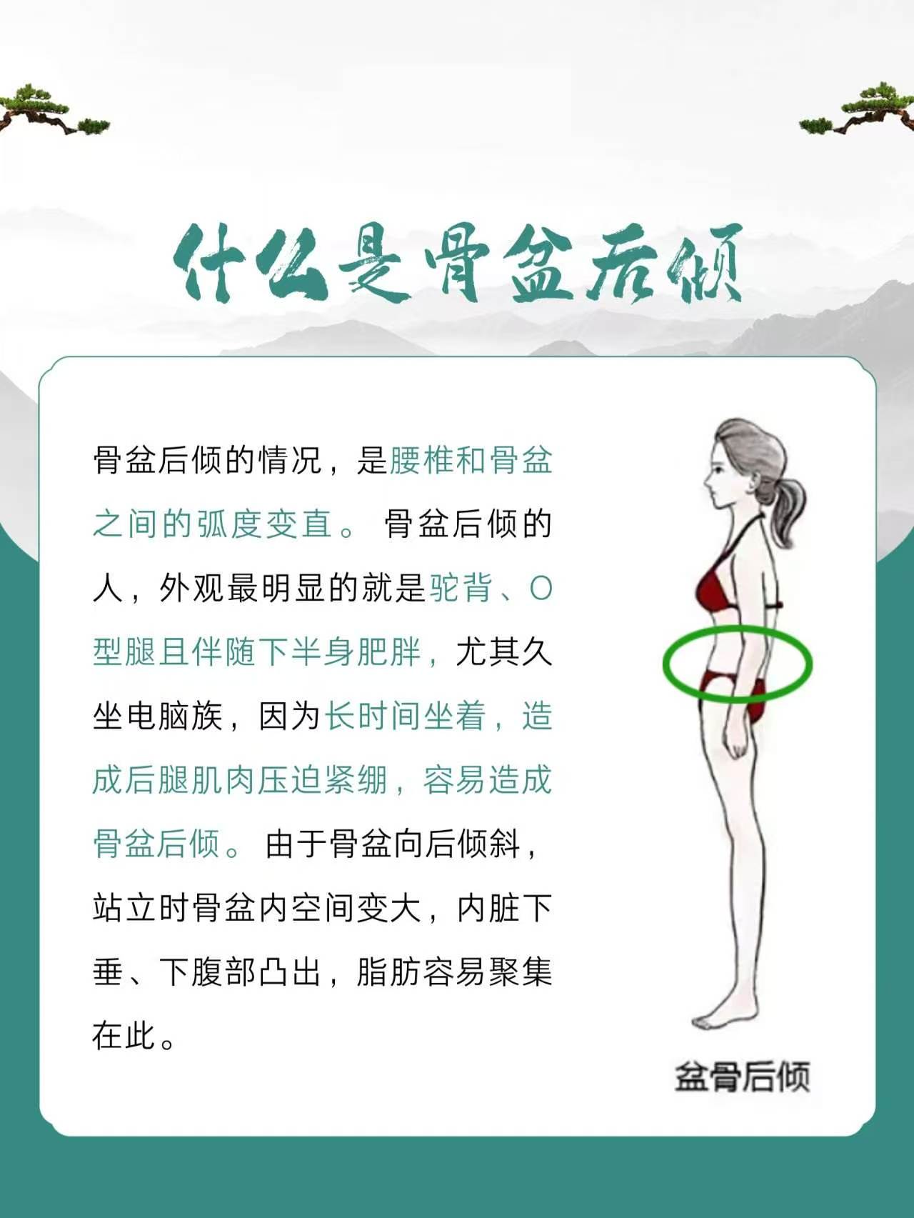 什么是骨盆后倾