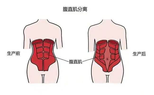 生完宝宝后出现这些问题你想过是为什么吗?...
