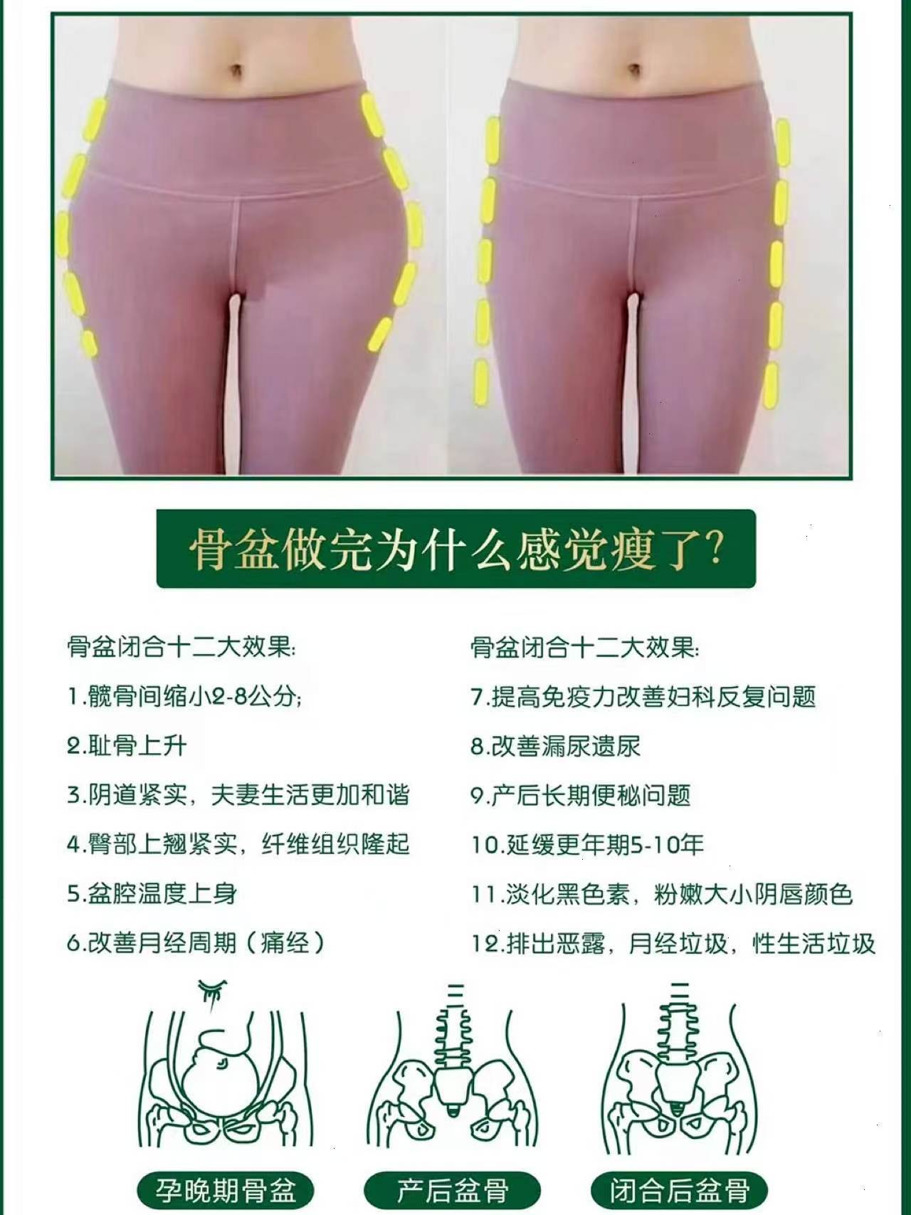 骨盆做完为什么感觉就瘦了？