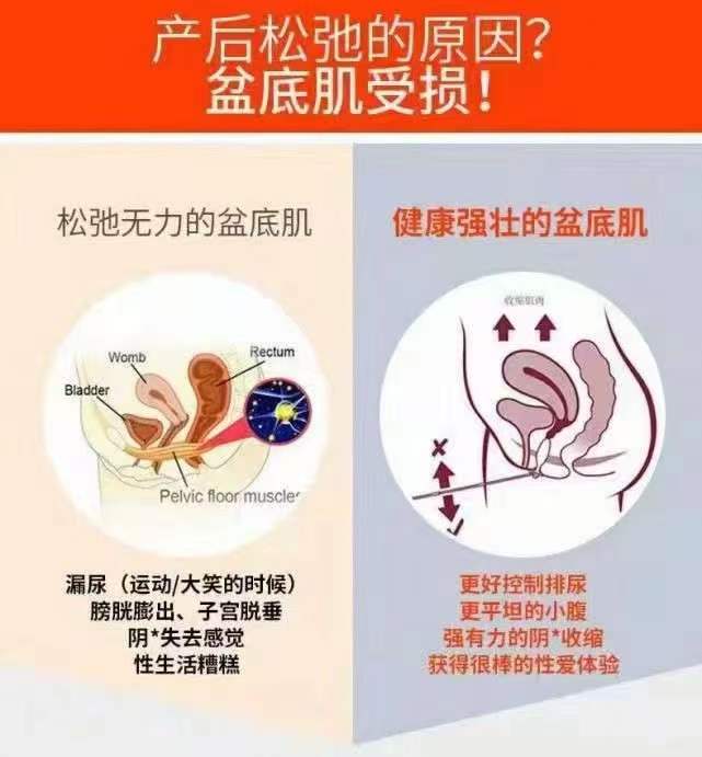 做骨盆修复会来带哪些好处呢?...