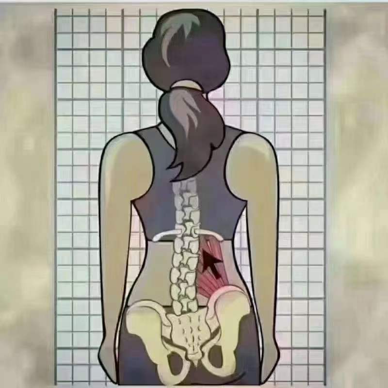 骨盆修复，不止是做了一个骨盆...