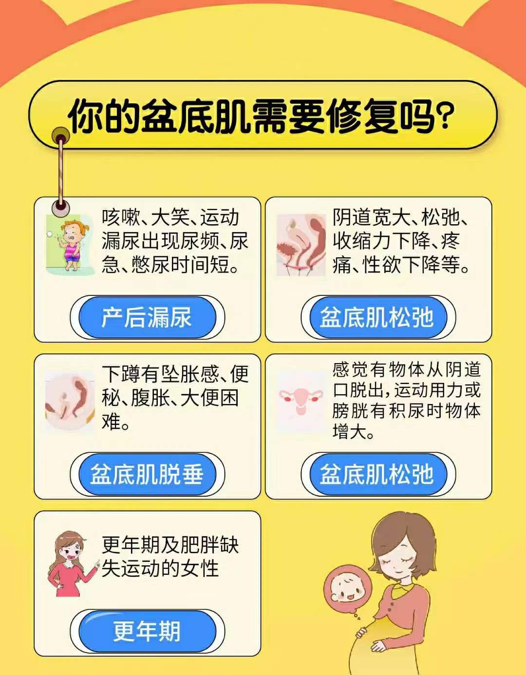 盆底肌松弛的自我检测