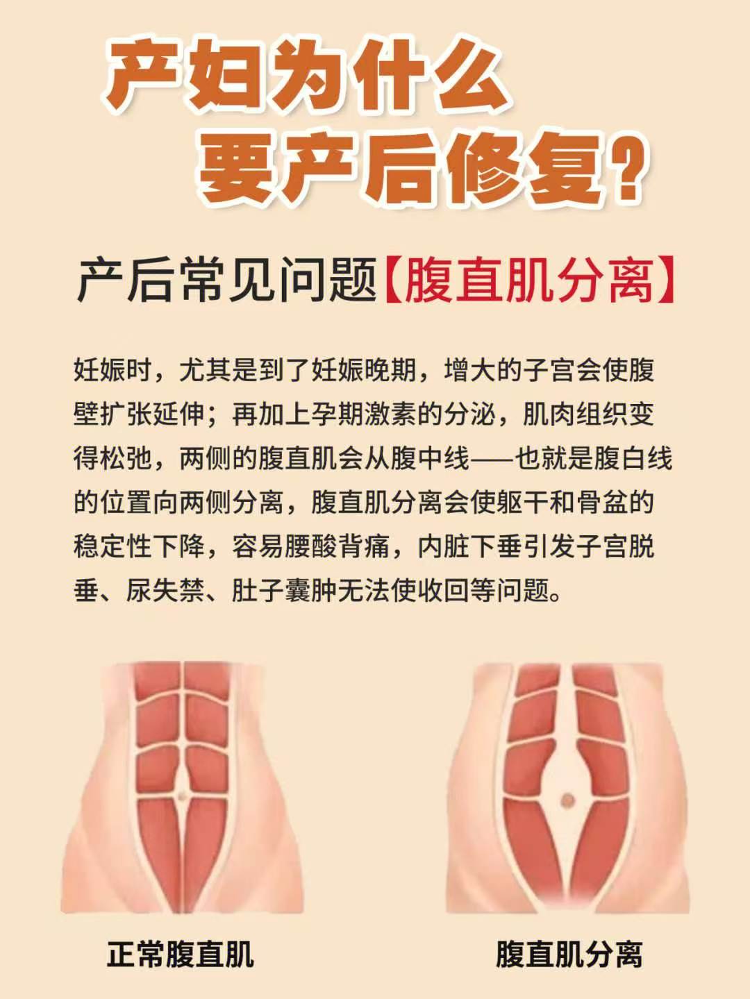 产妇为什么产后一定要做修复?