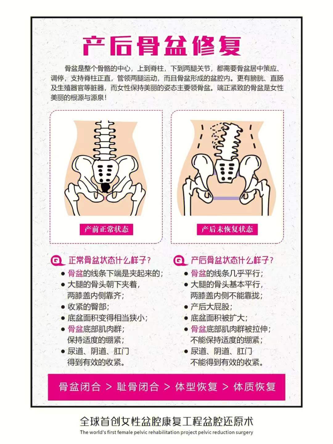 宝妈骨盆变‬形的烦恼