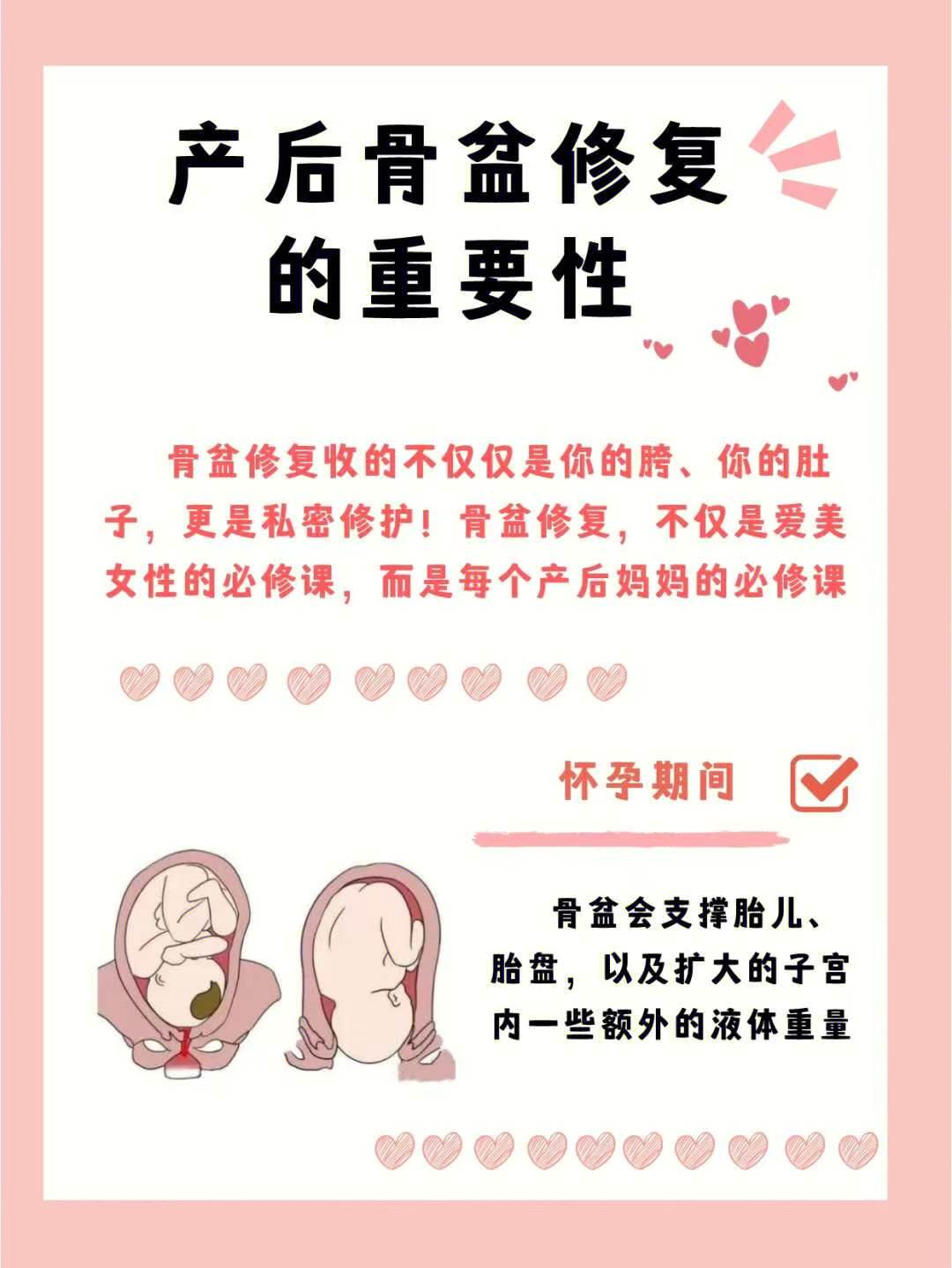 产后修复的重要性|||骨盆修复收的不仅仅...
