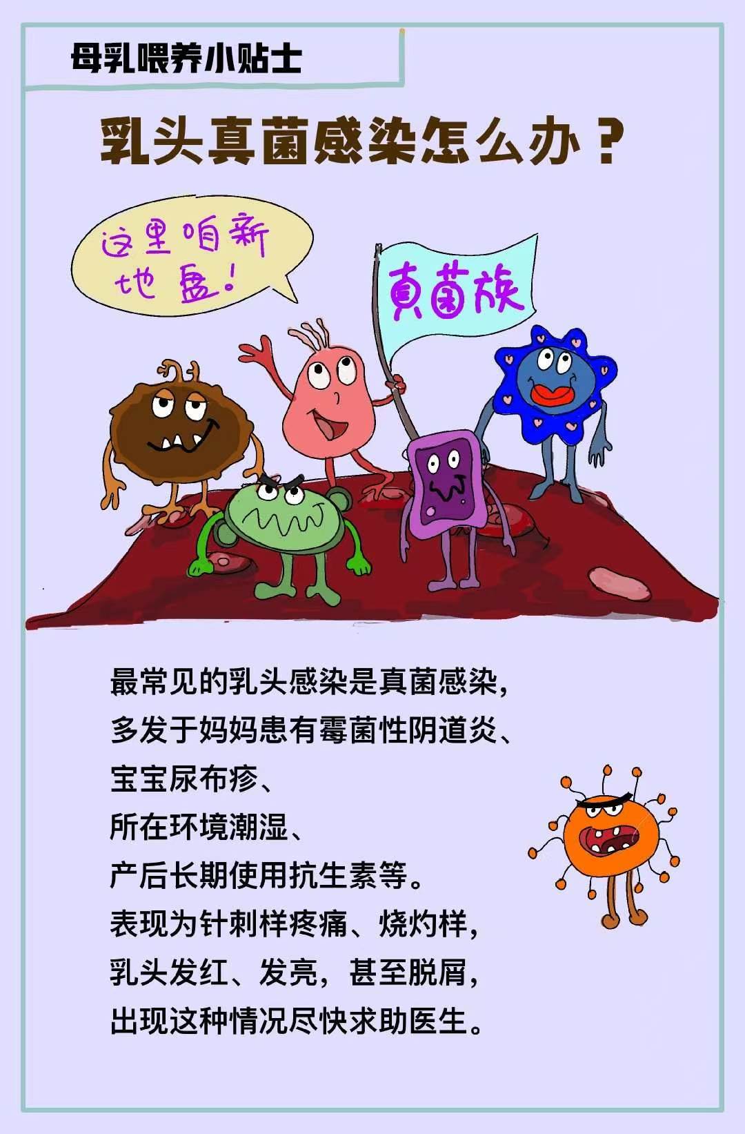 乳头真菌感染怎么办