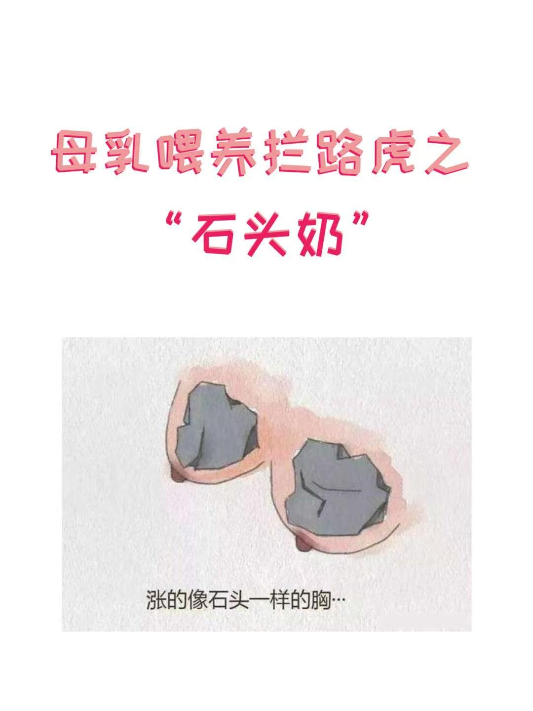 遇到生理性涨奶,到底该怎么办呢?预防是关...