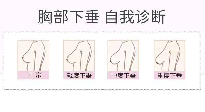 为什么生完孩子会胸部会下垂